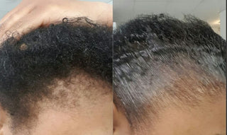 Edge Control for hair growth